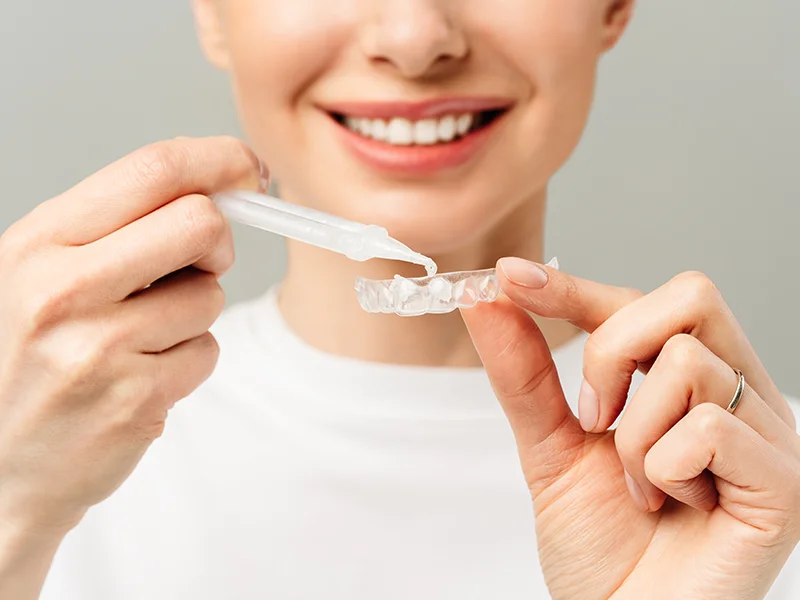 Close-up of a smiling woman applying cleaning gel to a clear dental aligner